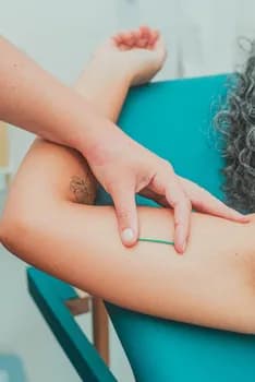 Imagem do IMPLANON DO ZERO